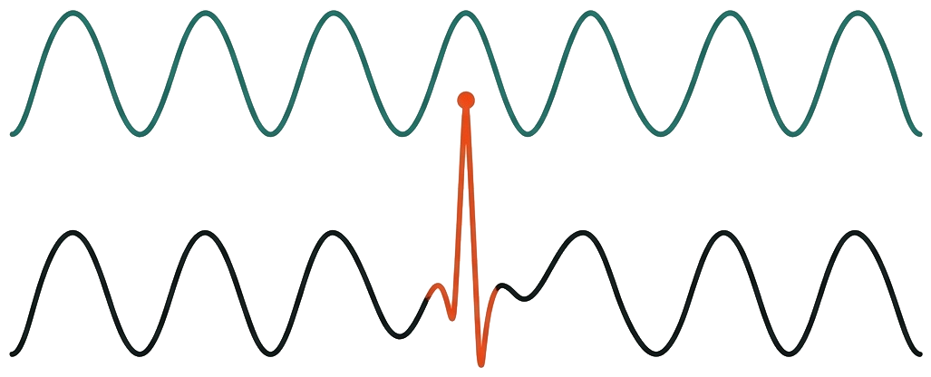 Line drawing of a vibration signal with an anomaly